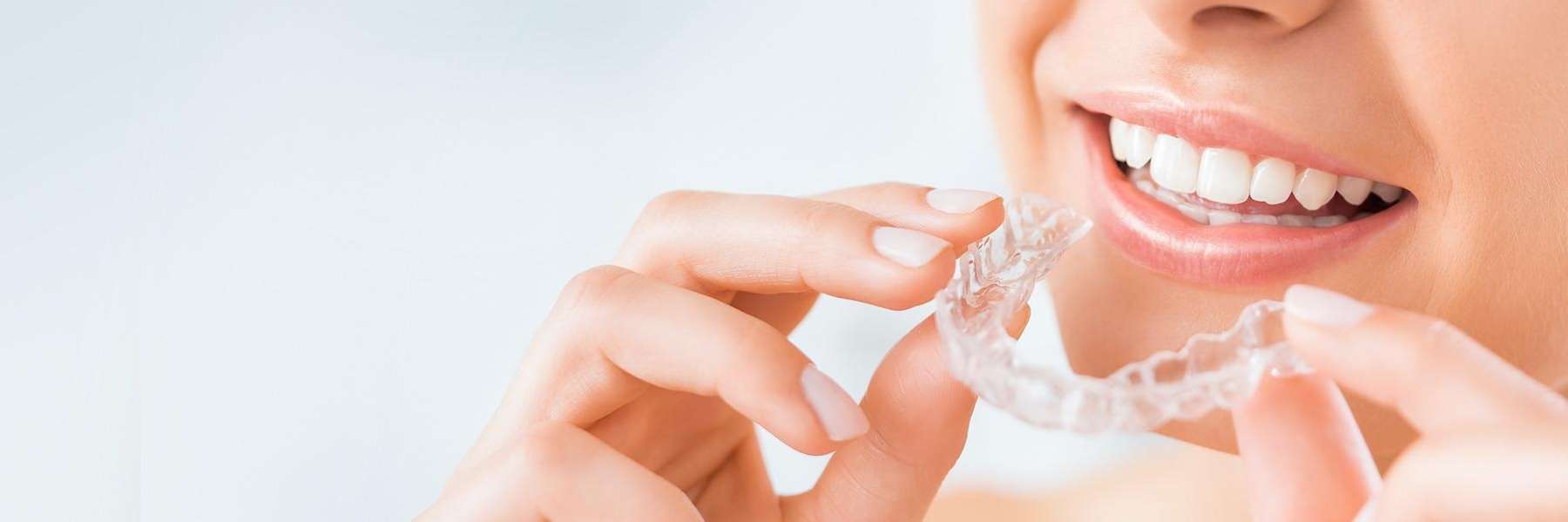 Invisible Clear Braces in Haymarket, Sydney | Dentist