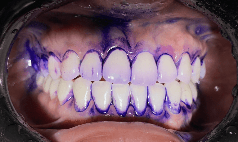 AIRFLOW-Dental-Spa-Before-Image